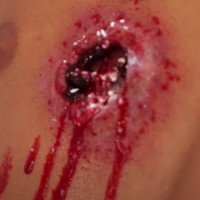 Comment raliser une plaie soufflante ?